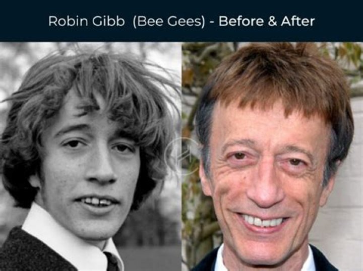 Remaining Bee Gees Members: Legacy And Current Projects
